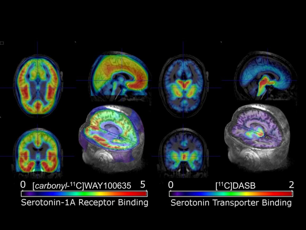cbmed_tracerimaging Tracer Imaging at CBmed