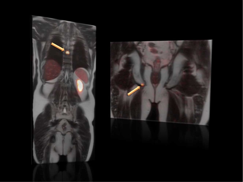 cbmed_tracerimaging2 In Vivo Imaging