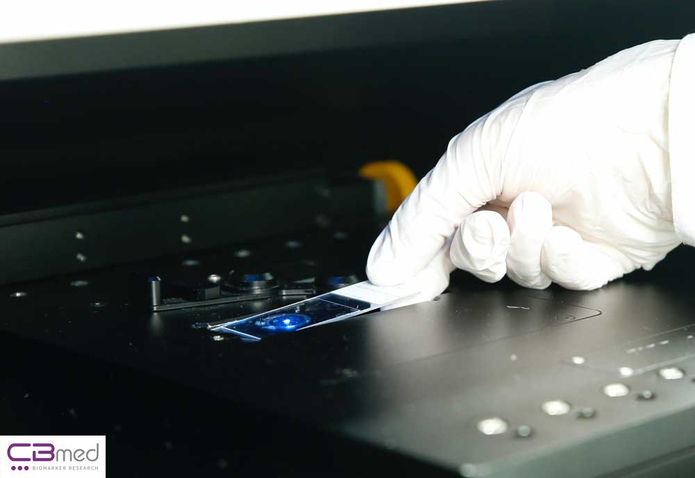 For Liquid Biopsy, CBmed uses most advanced technology.