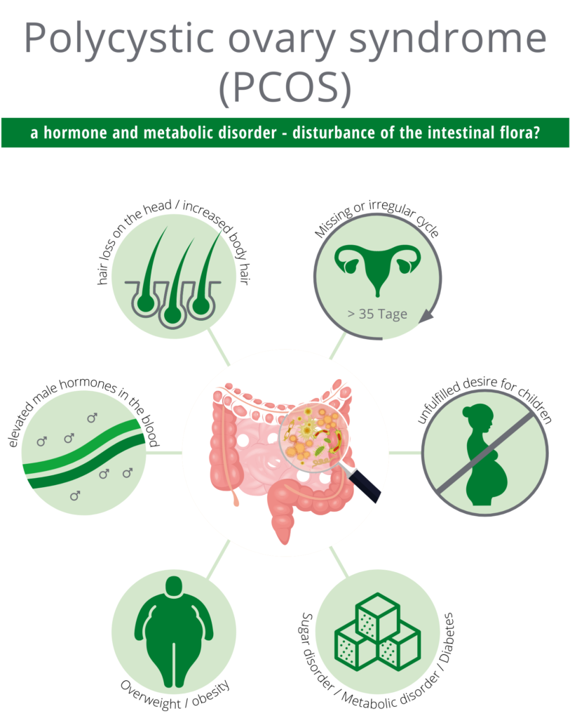 Polycystic ovary syndrome (PCOS) Polycystic ovary syndrome (PCOS)